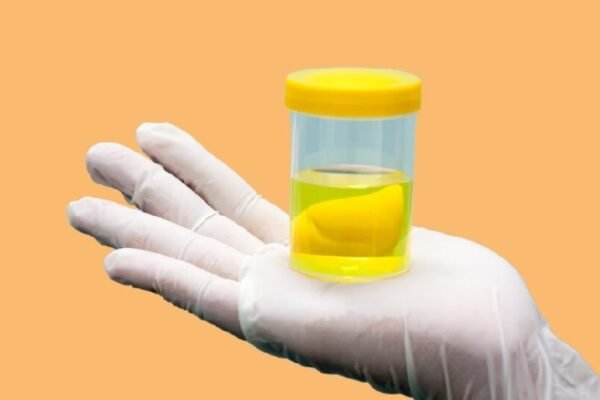 Sering Dianggap Remeh, Ini Pengaruh Urine Terhadap Kesehatan Ginjal