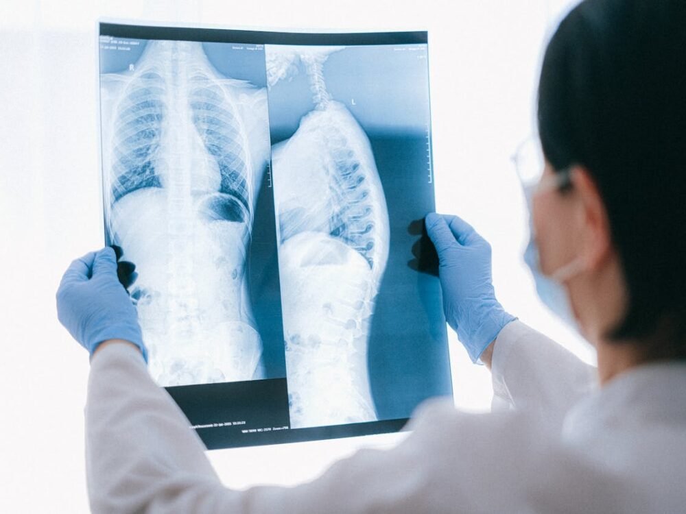 Penyebab Meninggalnya Catherine O’Hara Ternyata Emboli Paru, Kenali Gejalanya